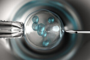 IVF in Colombia