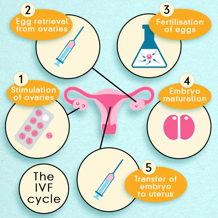 IVF treatment in Australia